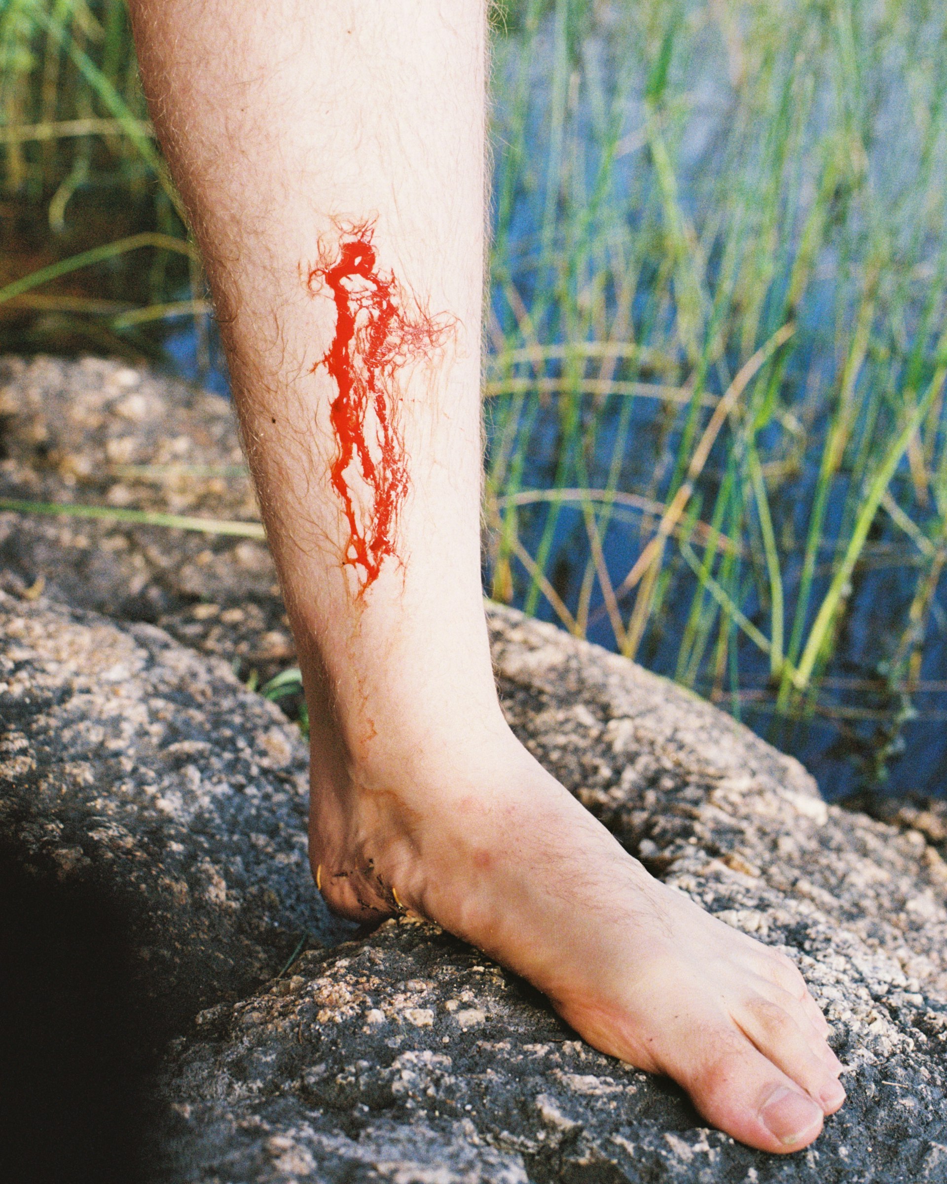Bloody leg